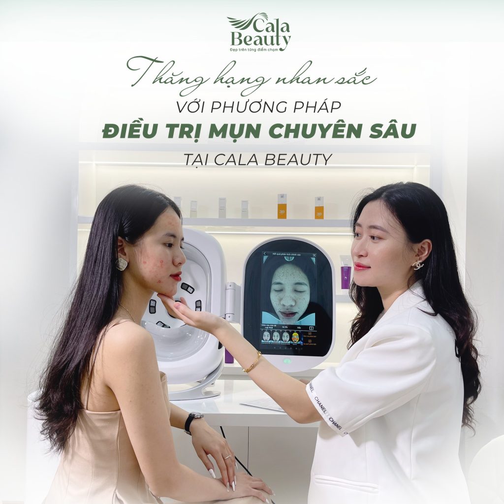 điều trị mụn chuyên sâu tại đống đa hà nội